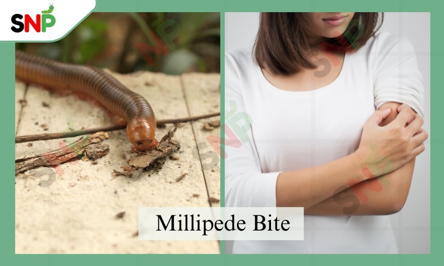 Millipede-bite